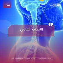 صورة بعنوان المقال