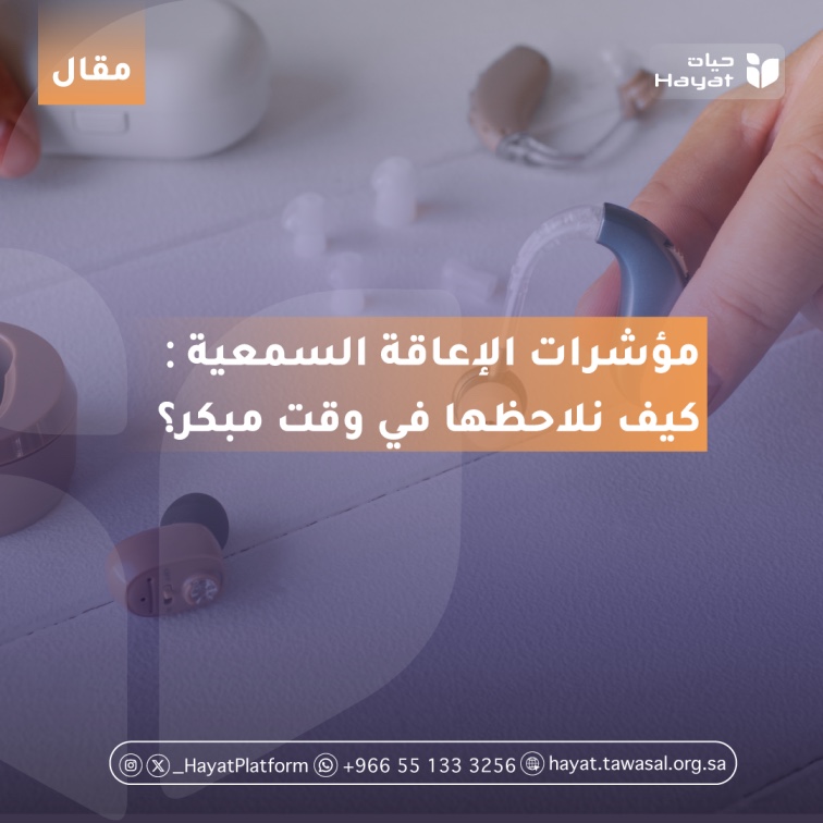 صورة بعنوان المقال