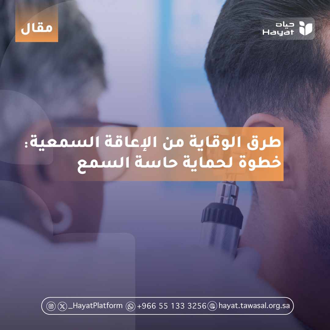 صورة بعنوان المقال