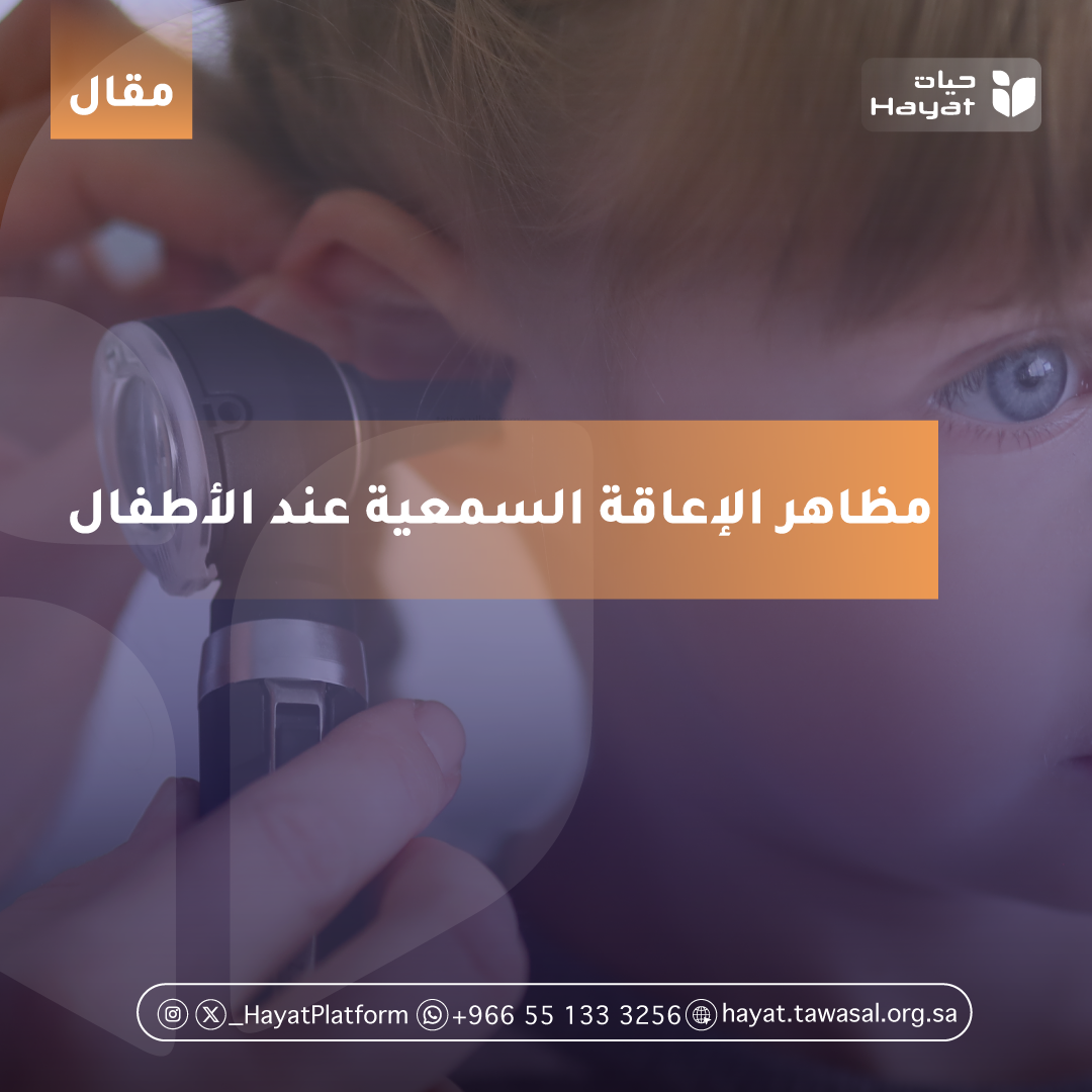 صورة بعنوان المقال
