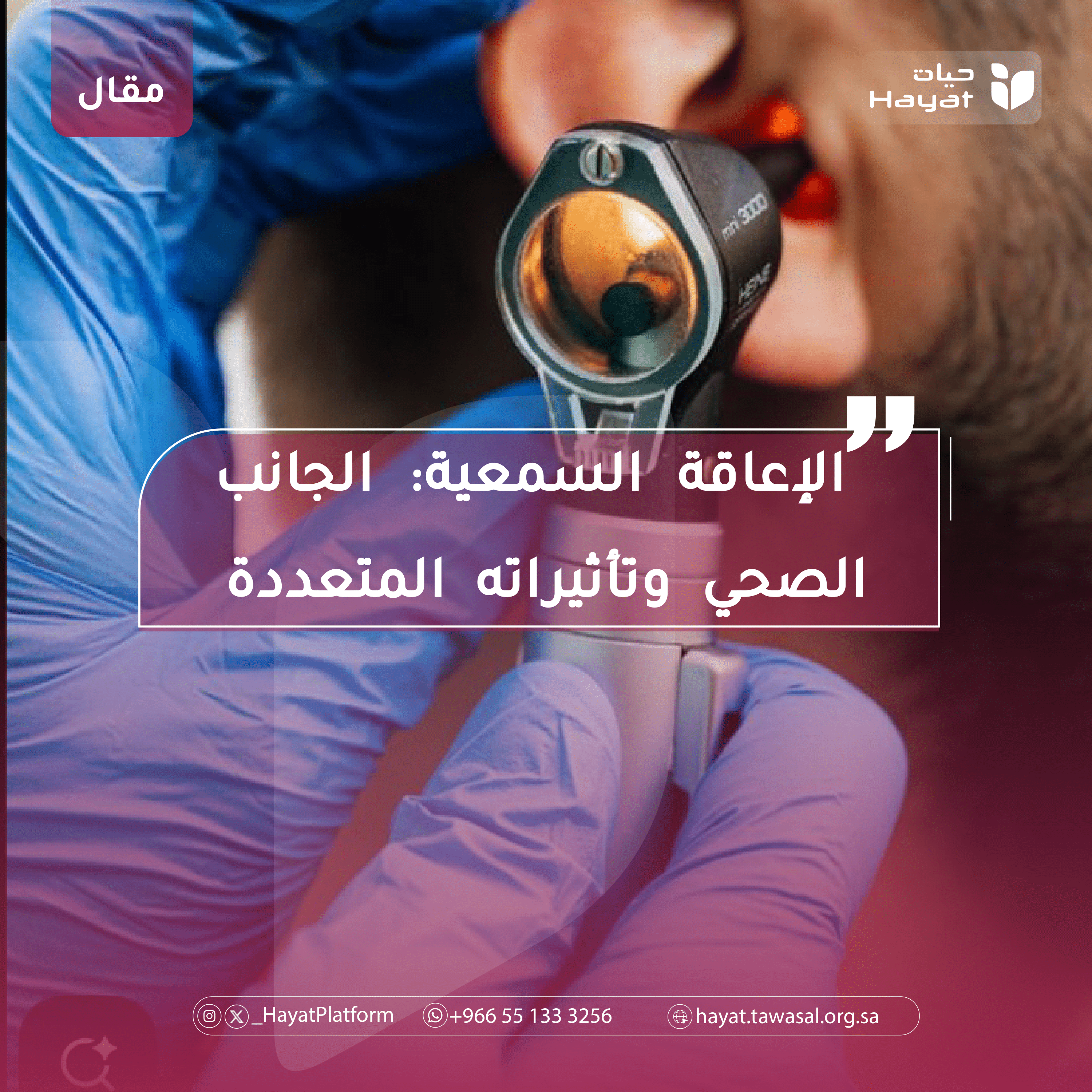 صورة بعنوان المقال