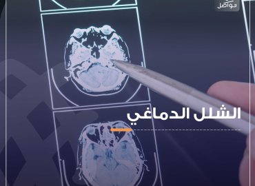 صورة اشعة لدماغ الانسان