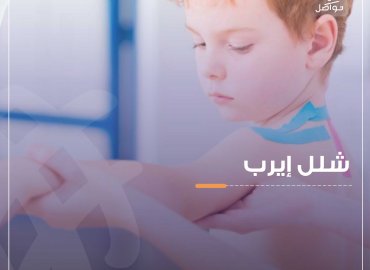 طفل مصاب بشلل إيرب