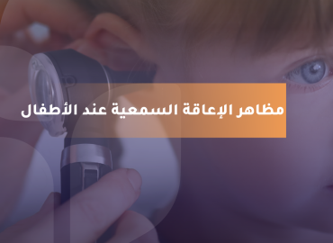 صورة بعنوان المقال