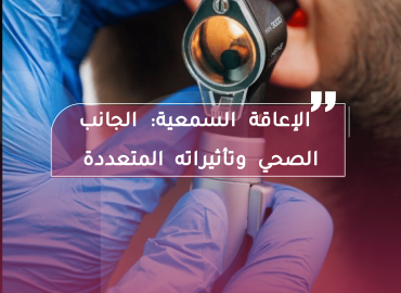 صورة بعنوان المقال