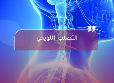 صورة بعنوان المقال