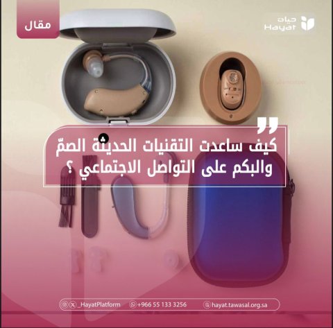 صورة بعنوان المقال